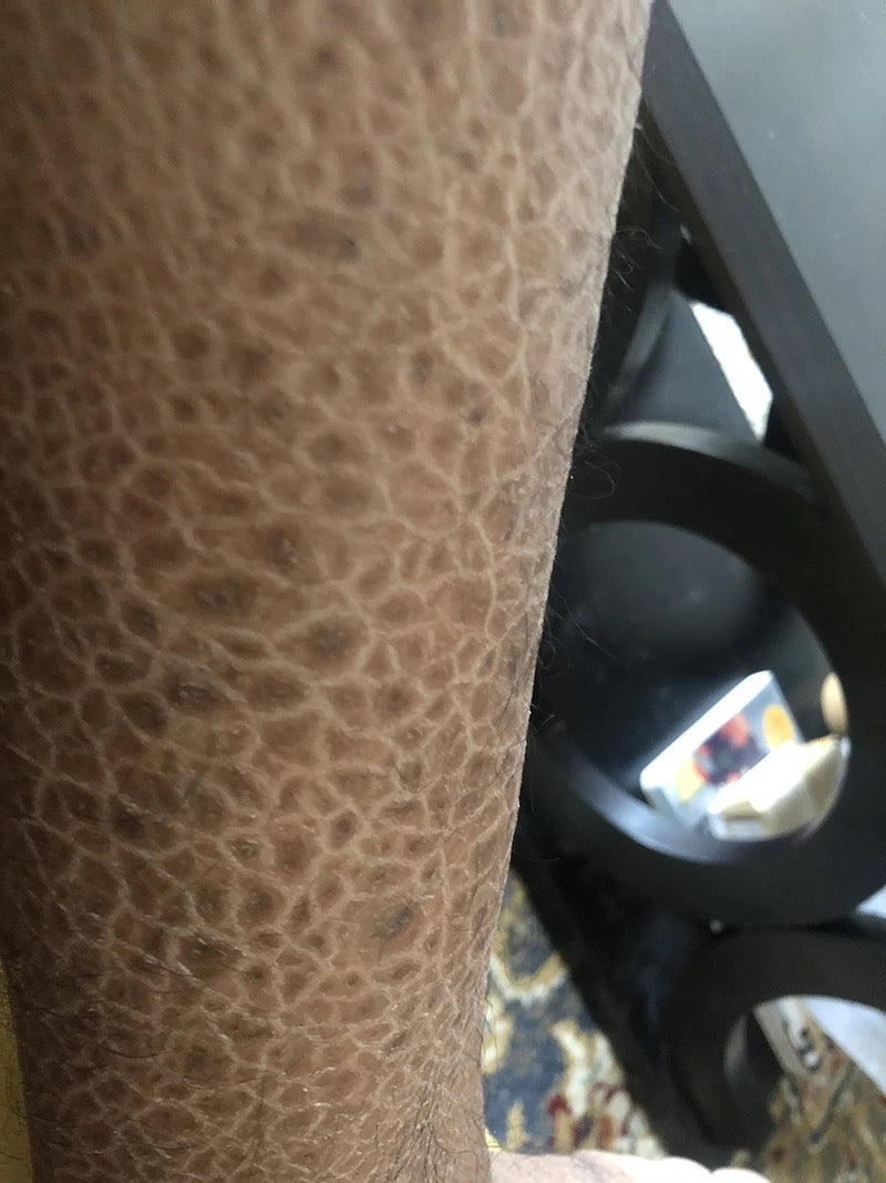 Horse oil cream by La Maricell with vitamin A and double glutathione.