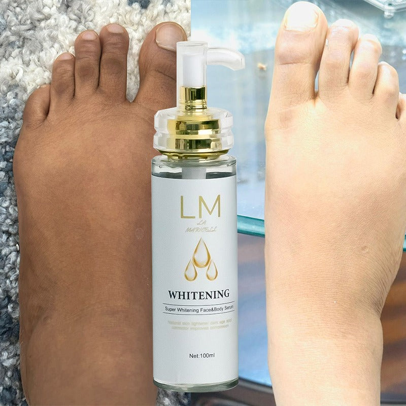 Before and after results using La Maricell whitening face and body serum on feet.